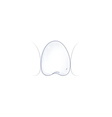 Zahnfarbe, Stufe 6 von 6