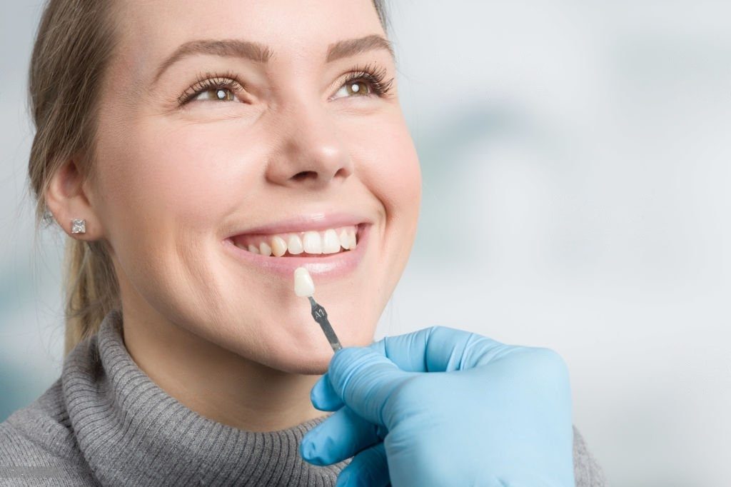 Lächelnde Frau mit Veneers